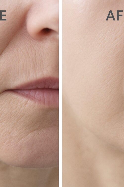 Fouka Lifting Night Cream – Κρέμα Νυκτός για Σύσφιξη & Ανόρθωση για ηλικίες 50+ 30ml