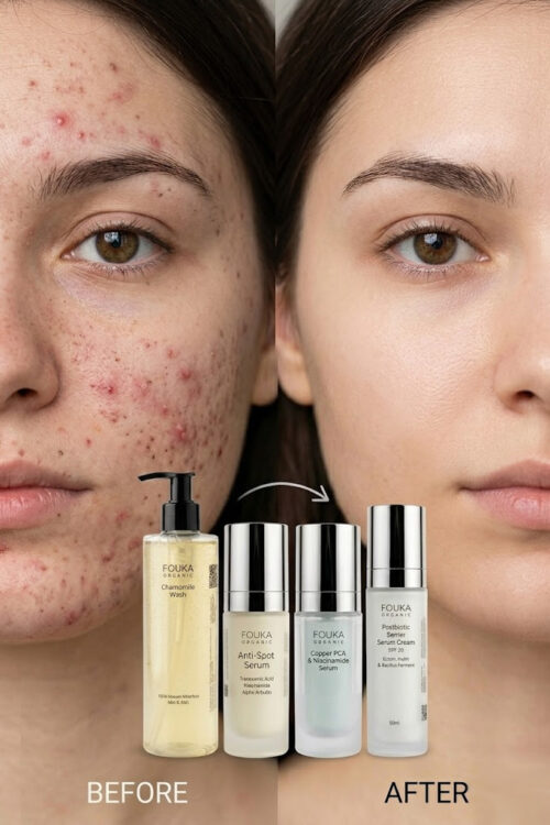 Fouka Clear Skin Protocol